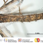 crv-esp-abd2